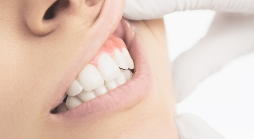I denti sani aumentano la fertilità